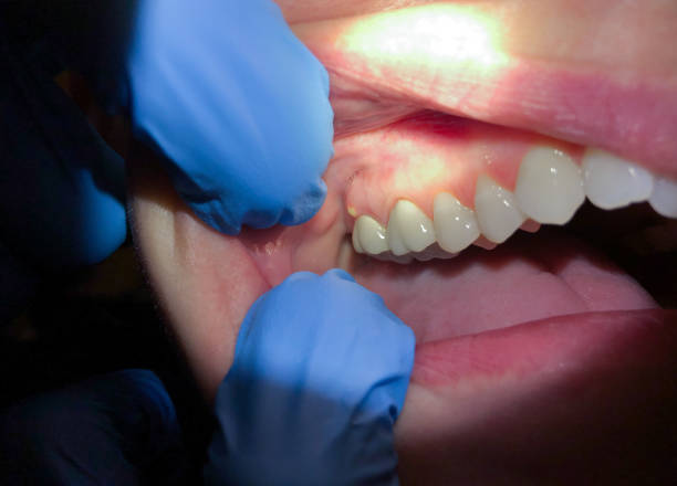  League City, TX Emergency Dentist Pros